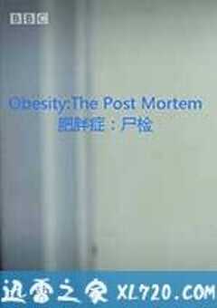 解剖肥胖 Obesity: The Post Mortem (2016) 4K网盘迅雷下载